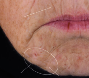 72k-face-serum-women-skin-lifting-correction-wrinkles-day56-after